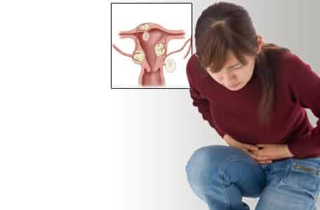 uterine fibroids surgery in india