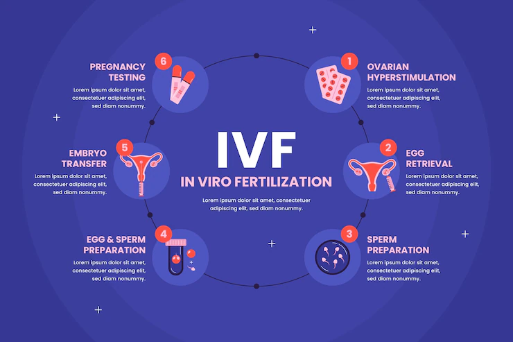 IVF Procedure in India