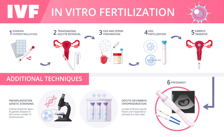 procedure of IVF treatment, IVF treatment in india, IVF procedure in India 