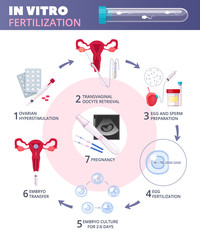 IVF treatment in Egypt