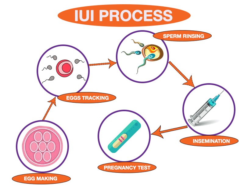 IUI Process Mumbai