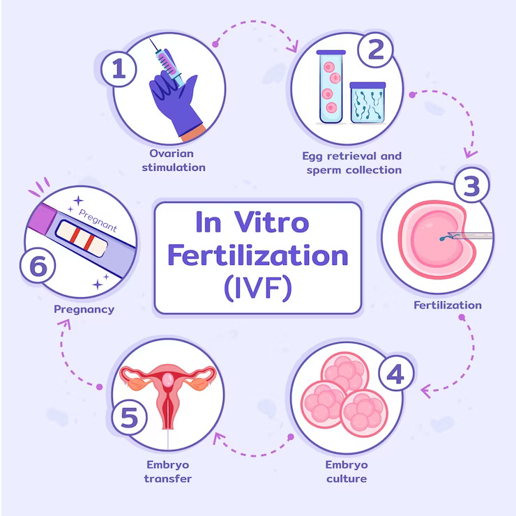 IVF Cost South Africa, IVF Clinic, IVF Centre, IVF Treatment