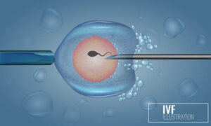 Cheapest IVF in Afghanistan