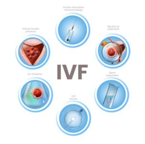 IVF  in Iraq
