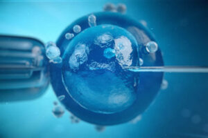 IVF in Iraq