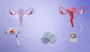 Egg Donation Rules In India
