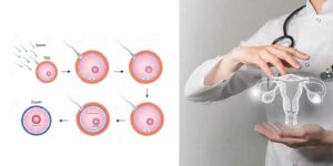 Fertility Treatment In India
